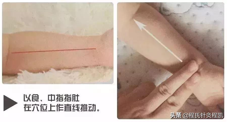 小儿荨麻疹中医反射推拿,荨麻疹夏季如何预防虫咬皮炎