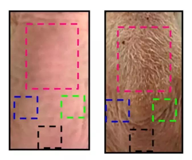 关于脱发生发的最新科技研究,生发帽治疗效果