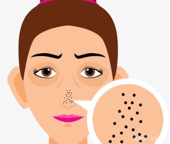 黑头快要出来的时候怎么办,黑头的前兆