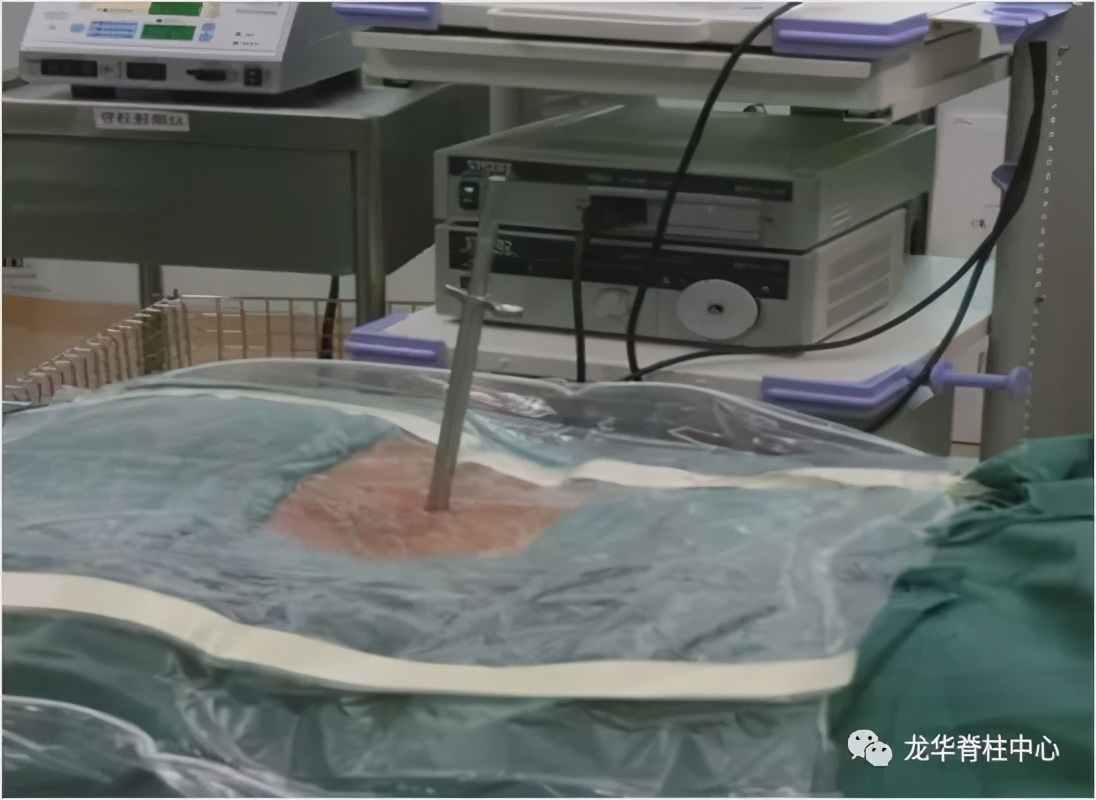 深圳市龙华区人民医院脊柱外科简介