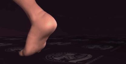 跟腱断裂康复论文,跟腱康复纪录片