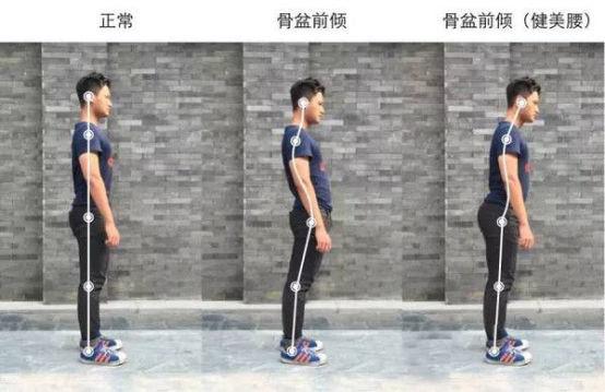 久坐会导致骨盆前倾还是骨盆后倾,开车久坐会导致骨盆前倾怎么纠正