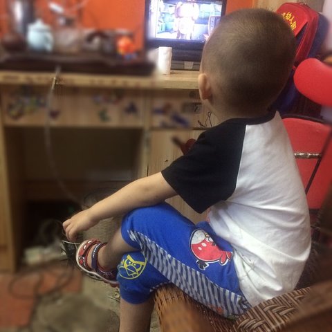 儿童天生长短腿矫正锻炼方法,小孩正常腿型发展