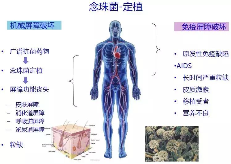 怎样确诊肺部真菌感染,侵袭性肺真菌病的确诊标准有哪些