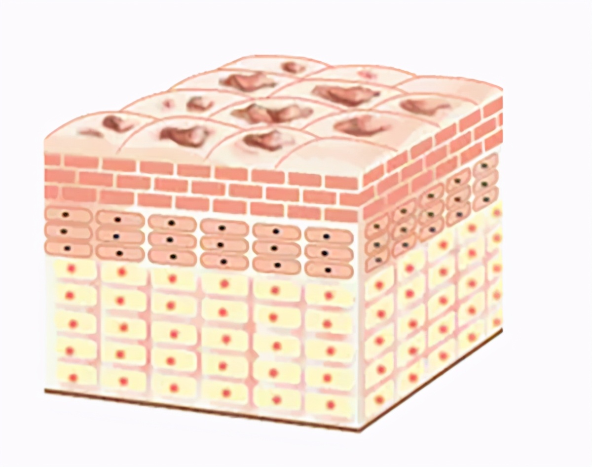 教你4个淡化黑色痘印的有效方法,改善痘印用什么酸效果最好