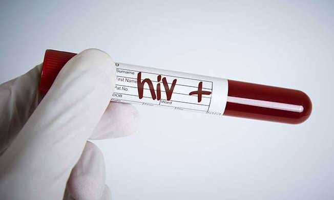 女性感染艾滋初期有什么症状,怎么知道目前感染艾滋病的阶段