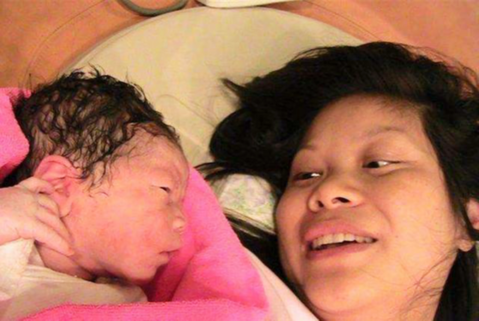 宝宝头上斑秃是什么原因造成的,是不是每个宝宝都秃顶