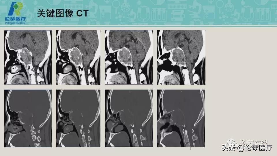 上海教授詹松华,上海曙光医院詹松华简介