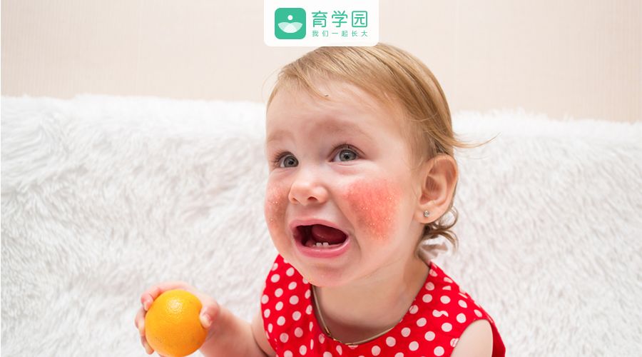 宝宝皮肤发红疹怎么办,宝宝皮肤发红粗糙还痒怎么回事