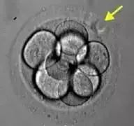 胚胎｜说说胚胎那些事