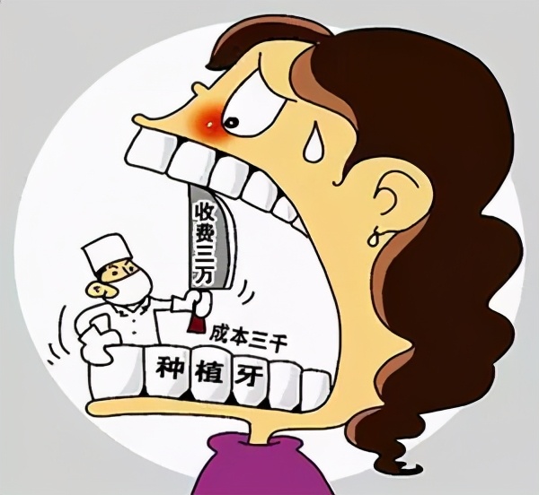 种植牙医院一般保几年,全口种植牙能用几年