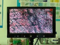 对虾黄鳃黑鳃是什么原因,对虾黄鳃防治