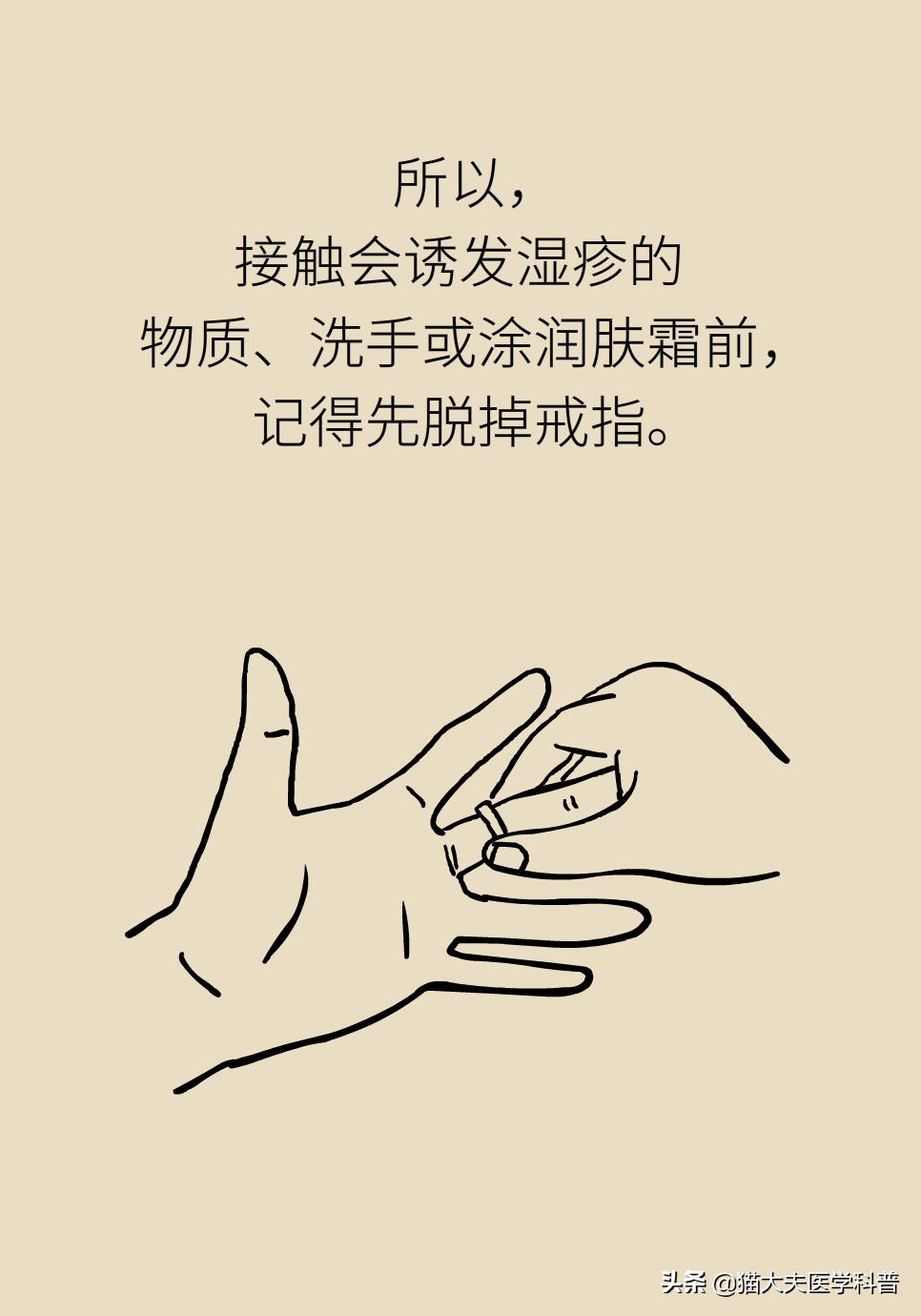 成年人手上总是长湿疹怎么办？