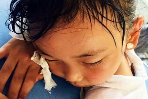 宝宝身上痱子痒怎么解决,宝宝身上长痱子可以擦爽身粉吗