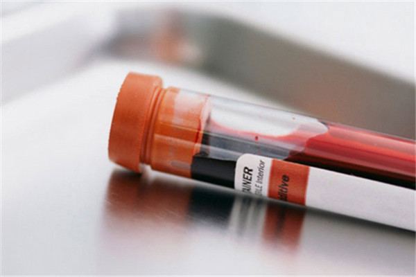 治疗急性痛风最好的方法是什么,急性痛风发作吃什么中成药