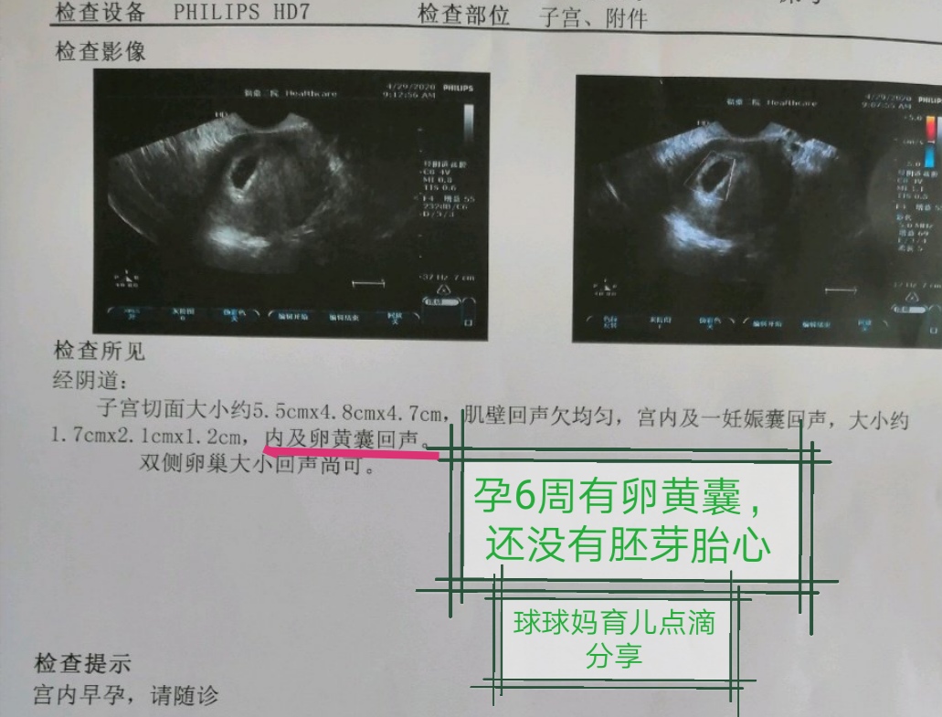 孕期报告单大全,孕期检查报告有哪些