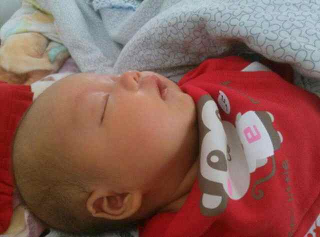 小孩脑袋凹进去一块,小孩头凹下去一圈