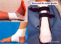 陈旧性踝关节损伤的治疗,踝关节损伤现场处理视频