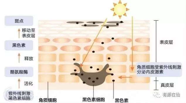 后背黑色痘印怎么消除,背部黑色痘印怎么消除