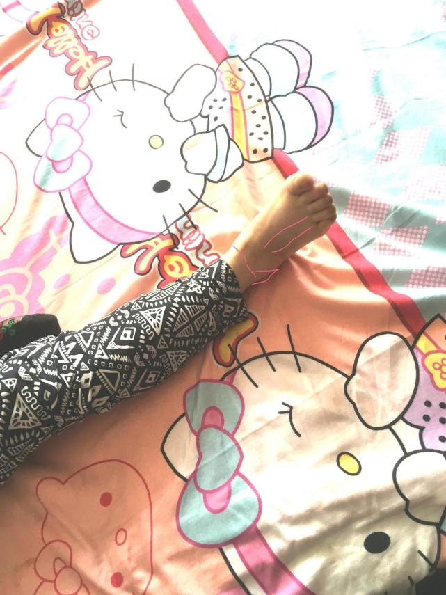 脚腕扭伤几年了脚腕还疼怎么运动,扭伤脚腕怎么处理