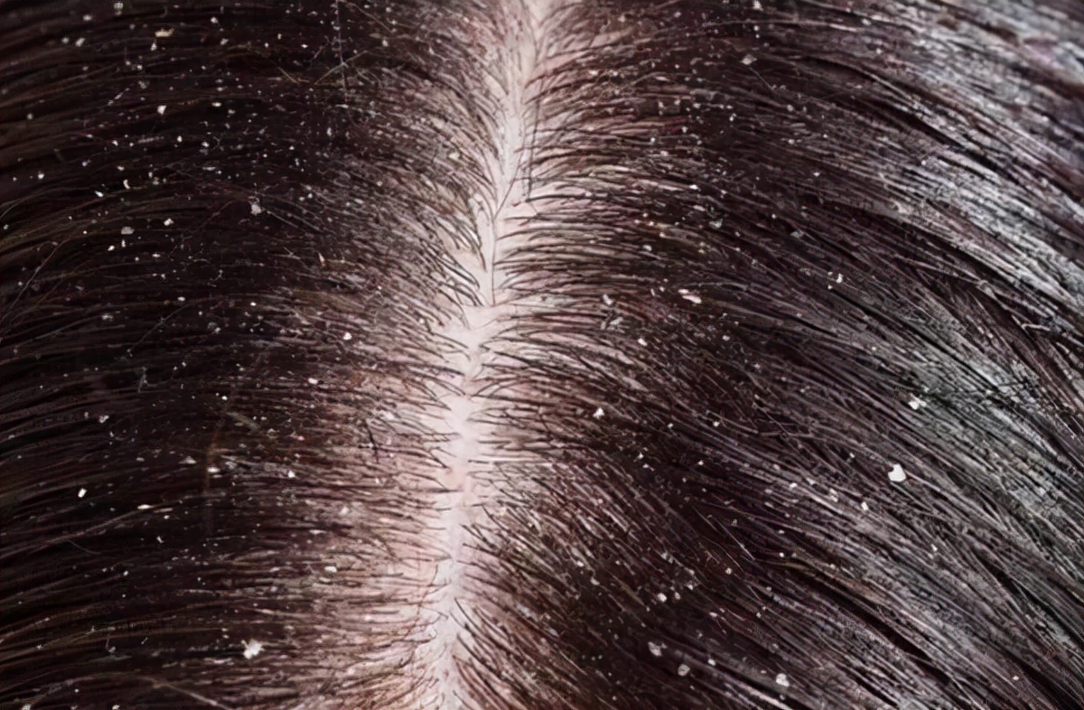 2块钱硫磺皂有什么弊端,2块钱的硫磺皂的妙用