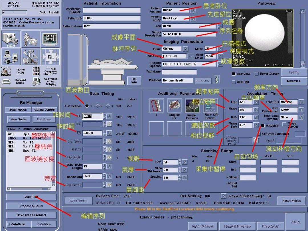 脊柱mr扫描规范,MR扫描各序列特点
