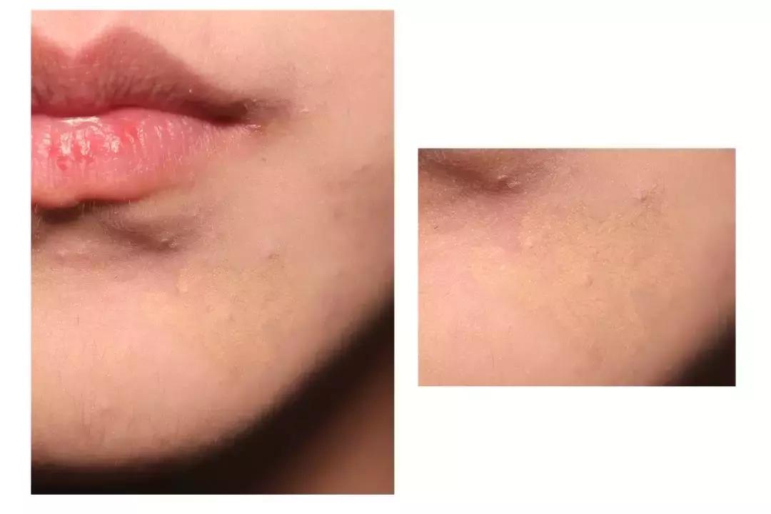 缇庡鐨偆绠＄悊鍖栧,缇庡闄㈠仛鑲岃偆閬憰