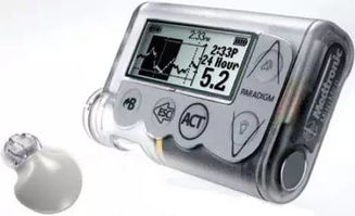 胰岛素泵科普;降伏糖魔的绝招是什么?这4点好处让糖友又爱又恨