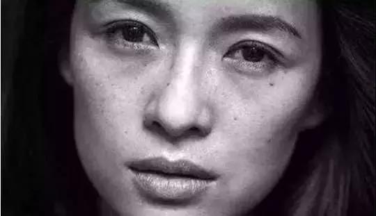 长出的斑怎么消除,长色斑怎么办5大方法祛除色斑