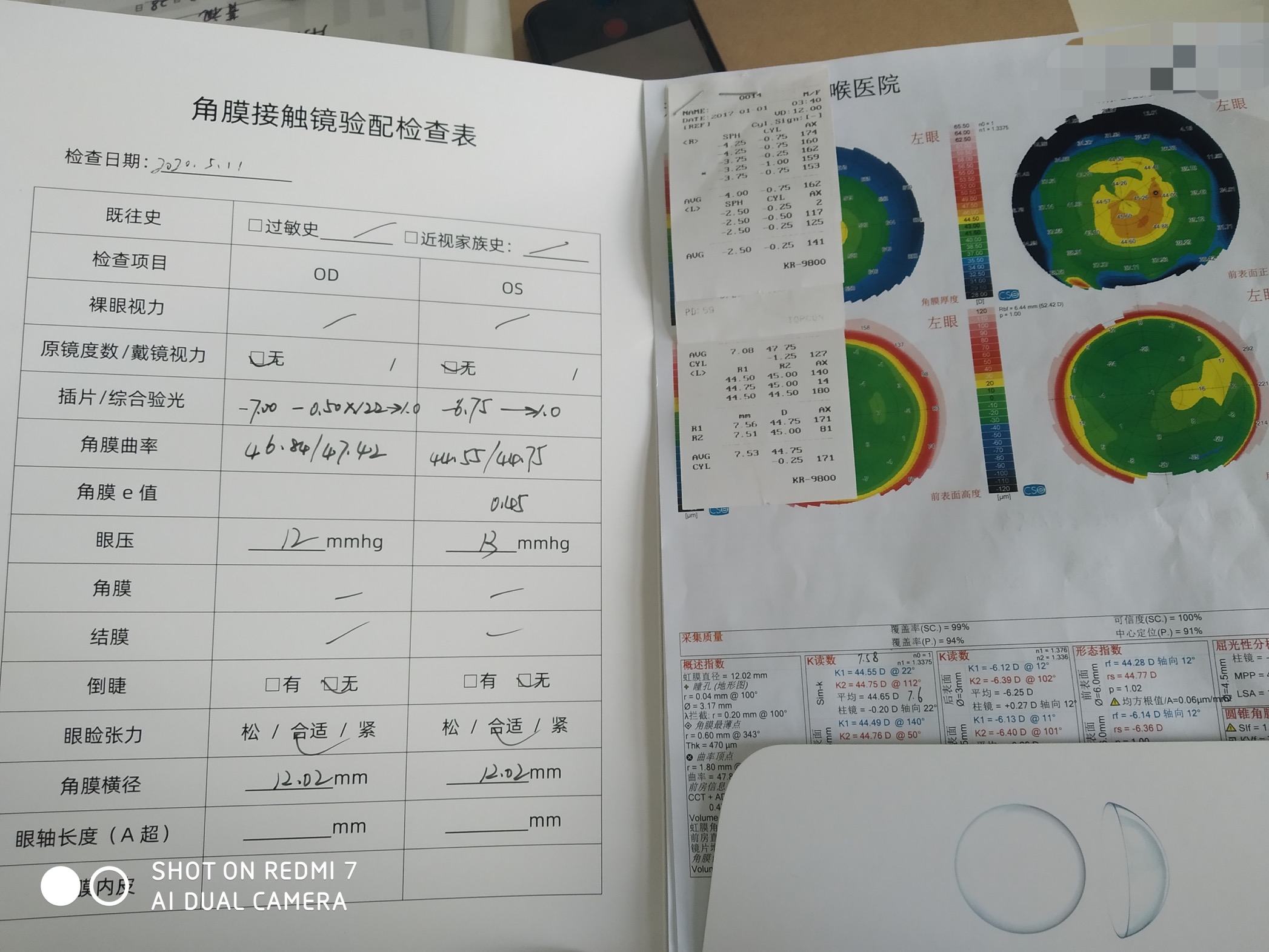 治疗儿童近视的仪器真的有用吗,2000度近视50岁怎么治疗