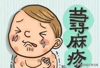 春天花粉过敏脸上起疙瘩,花粉过敏起疙瘩涂什么药