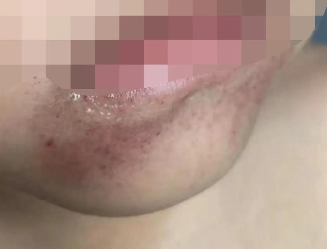 身上出现这种红点千万要注意,身上出现了许多小红点怎么治疗