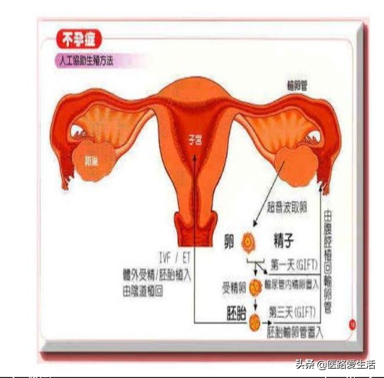 女人不孕不育十大原因,女人不孕不育祖传秘方