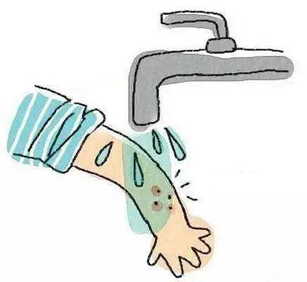 猫狗咬伤如何正确处理,被猫狗抓伤或咬伤的急救