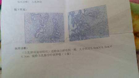 拆线伤口还疼可以拆线吗,术后拆线多久可以用疤痕修复