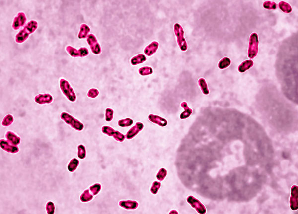 一百多年前香港“防疫竞赛”他输了比赛却赢得称赞