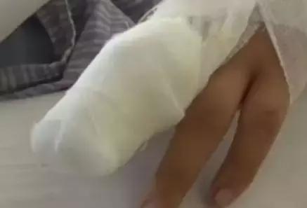 酱油清肠,避孕药洗头,这些自杀式养生为什么总有人信?