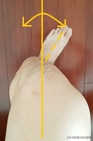 体态矫正小腿外翻,成年人x型腿加膝外翻怎么办