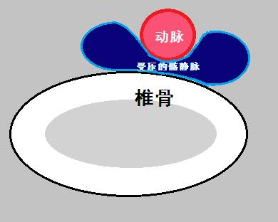 为什么肿腿,一条左腿浮肿是什么原因