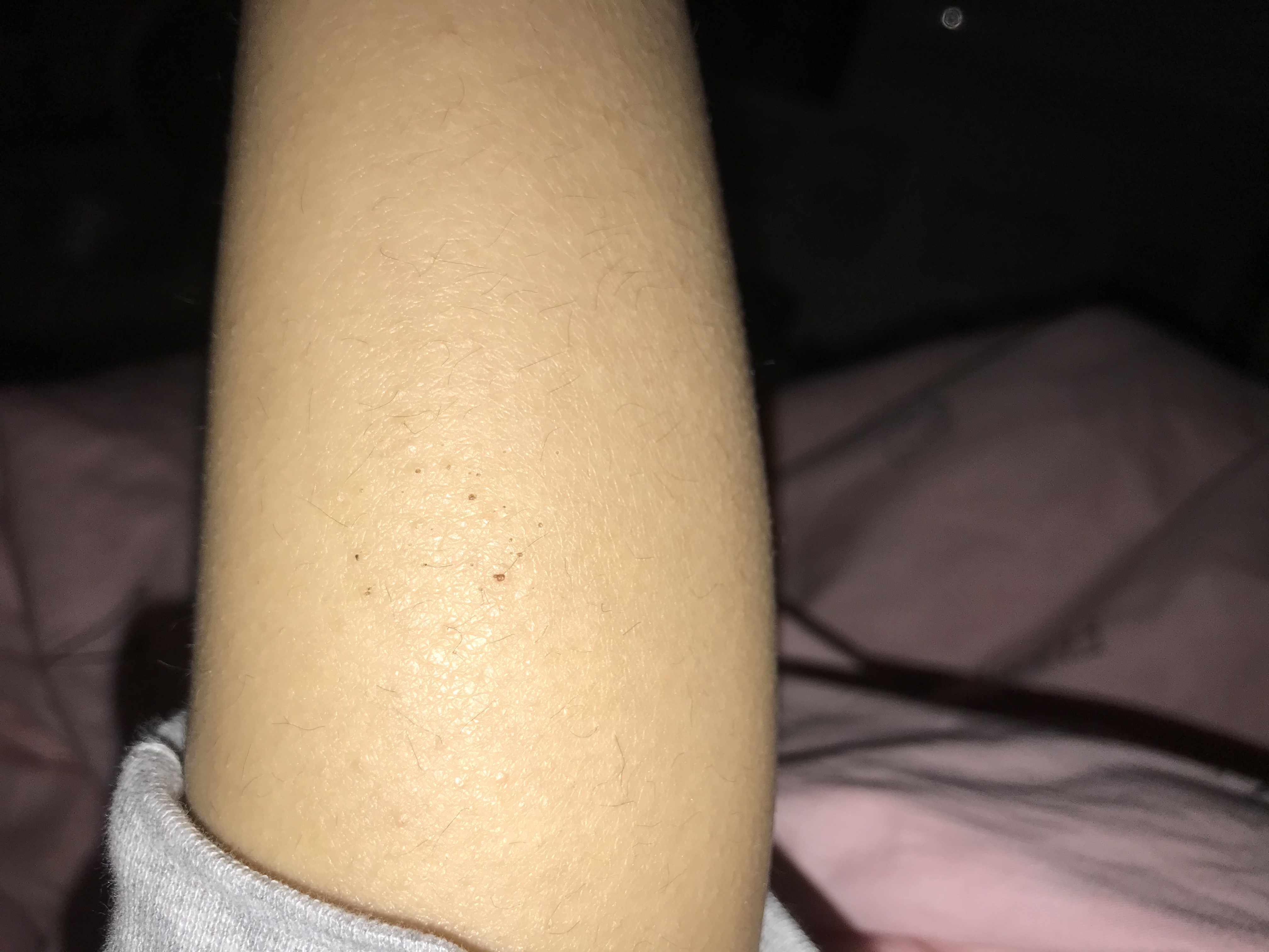 宝宝腿发痒挠破了伤口一直不愈合,宝宝腿很痒怎么快速止痒