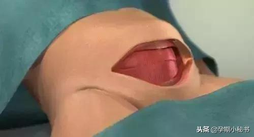 顺产生孩子剖腹产的真实流程,顺产剖腹产生孩子的真实流程