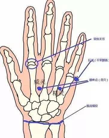 针灸治疗痛症的选穴原则,针灸奇穴疗法大全