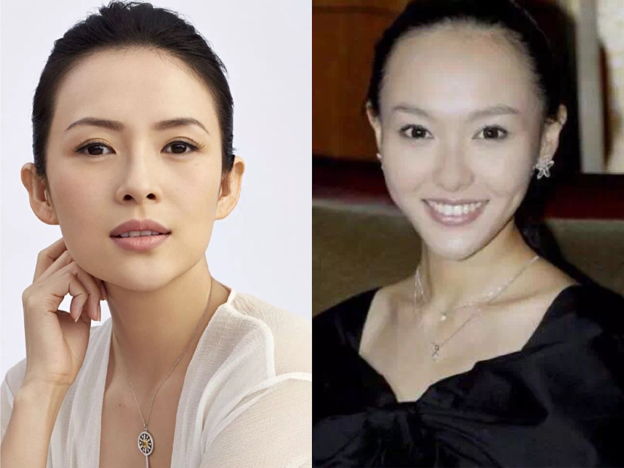 雄性激素脱发怎么自救,自救脱发最有效的方法