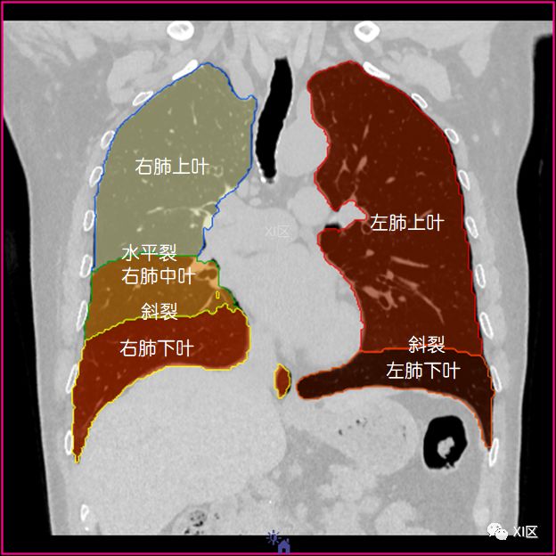 如此详细的肺部影像解剖，有点儿酷！