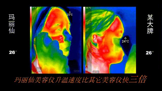 玛丽仙美容仪选择,写出你最想咨询的几个问题