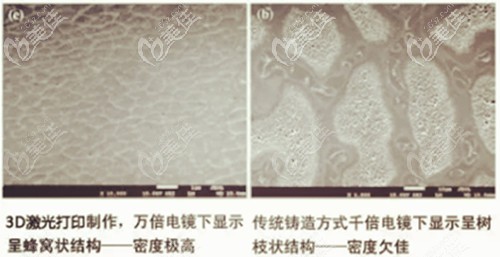 3d打印烤瓷牙技术视频,3d打印烤瓷牙的优缺点