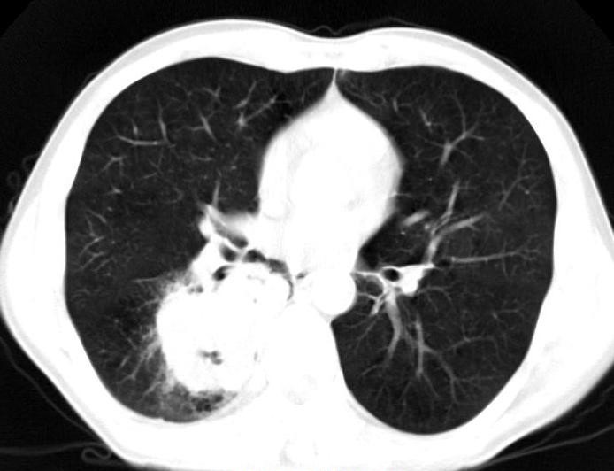 体检省钱又有效,体检去哪里做比较靠谱