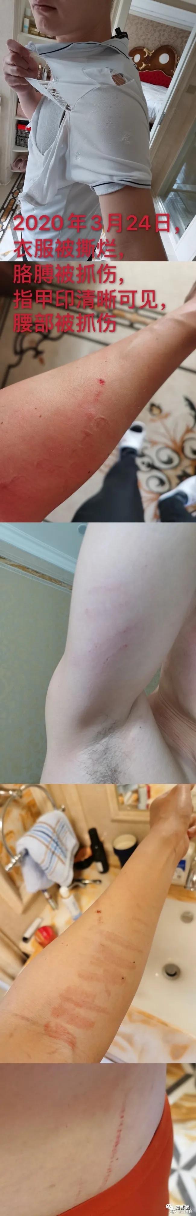 短跑名将张培萌家暴事件,短跑名将张培萌殴打岳母视频