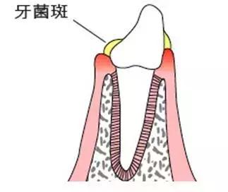 一口黄牙能洗白吗,一口黄牙毁了一张脸