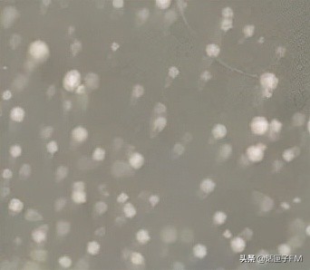 面膜菌落超标不合格的原因,面膜菌落超标